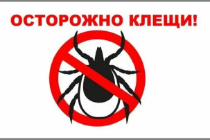 Клещи Клещи.